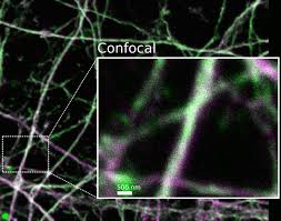 Tested in immunofluorescence (if), immunocytochemistry (icc) and flow cytometry (flow) applications. Super Resolution Scientific Volume Imaging