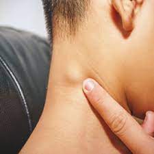 تعرف على أعراض الإيدز بالصور ويب طب