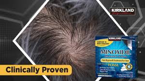 Soft bouncy waves with british m. Kirkland Signature Hair Regrowth Treatment Minoxidil Foam For Men Costco