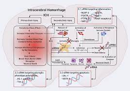 Progress On Sirna Based Gene Therapy Targeting Secondary Injury After Intracerebral Hemorrhage Gene Therapy