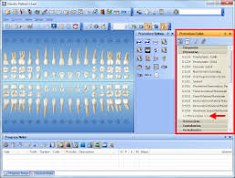 Dentrix Tip Tuesdays Customizing The Procedure Code List In