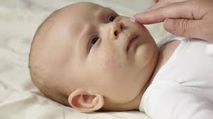 Baby Acne Neonatal Acne Definition Symptoms Causes Treatment