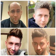 There is nothing shameful about dyeing your hair. The Guide To Choose The Inspiring Mens Hair Dye Ideas