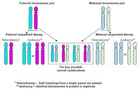 Russell Silver Syndrome Genetics Home Reference Nih