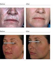 Before And After With Environ Skinare Cosmetics Beauty Skin Care Beauty Hacks Skincare Skin Care Spa