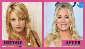 Kaley Cuoco Plastic Surgery Before And After Kaley Cuoco Plastic Surgery Kaleyc Cuoco Kaley Kaleyc Pla Cuoco Kaley Cuoco Prominente Plastische Chirurgie