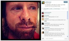 Switchfoot singer has surfing mishap