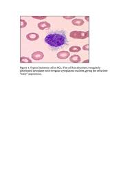 In the second treatment phase, steps are taken to kill any remaining leukemia cells that could cause a relapse. Hairy Cell Leukemia Cancer Therapy Advisor