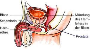 Urologenportal Nieren Und Harnwegsinfektionen