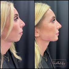 Dr Rick Und Nick Dr Ricks Behandlung