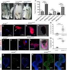 I just want to break you down so badly. Setdb1 Modulates The Differentiation Of Both The Crystal Cells And The Lamellocytes In Drosophila Sciencedirect