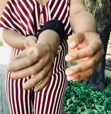 Stories — The Lauren Scruggs Kennedy Foundation