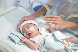 Mit dem thema „frühchen habe ich mich jedoch nie so richtig auseinandergesetzt und verstand nicht die tragweite bis ich auf der neonatologie meine kinder zum ersten mal sah. Fruhgeborene Kinder Mit Atemnotsyndrom Wirkungsvoll Behandeln