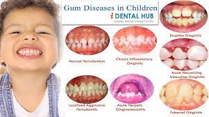 Pin En Dental Assistant