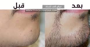 طرق زيادة شعر اللحية الخفيف عند الرجال ثقف نفسك