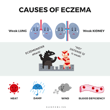 How Does Chinese Medicine View Eczema Kanpobliss Medicine For Eczema Eczema Treatment Chinese Medicine