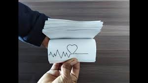 Life Line Flipbook How To Make Flipbook Simple Flipbook Step By Step Flip Book Flip Book Animation Easy Flip Book