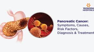 Jaundice usually occurs without abdominal pain. Pancreatic Cancer Symptoms Causes Risk Factors Diagnosis Treatment