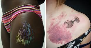 The time it will take to tattoo the stretches is usually 2x longer since more ink will have to be applied to your scars. 65 Tattoo Artists Who Made Stretch Marks A Sight To Behold