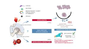 Image result for Myocarditis