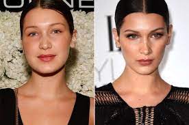 We bring you the same digital imaging technology that surgeons use to visualize plastic surgery results — all in a super easy to use app! Did Bella Hadid Get A Nose Job Page Six