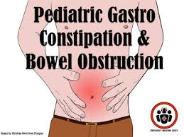 Image result for Pediatric Constipation
