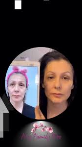 🕒✨ Discover the magic of the Y-Lift, our non-surgical 20-minute facelift  that delivers instant youthful volume and contour. Why wait for beauty?  Achieve stunning results without downtime. Schedule ...