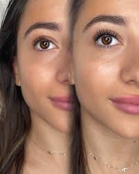 Lash lift shields and rods for optimal results