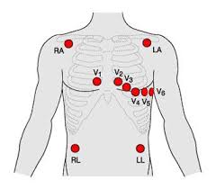 12 lead ecg placement medical stuff medicina