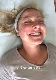 Con la dolcissima Elena ci siamo viste la prima volta in studio 7 mesi fa!  Elena presentava una rosacea sulle guance, alcune aree ipersensibili,  mentre altre con croste e ispessimenti che, ...