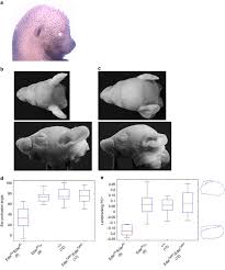 To be a little more specific, they were scid, or severe combined immunodeficient, mice. A Genome Wide Association Study Identifies Multiple Loci For Variation In Human Ear Morphology Nature Communications
