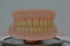 Diy kits to make dentures instructions on how to make false teeth 3. Diy Dentures A Post Surgical Plan 12 Steps With Pictures Instructables