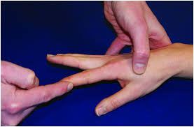 Flexion of thumb ip joint; Hand And Wrist Clinical Cases Chapter 9 Postgraduate Orthopaedics