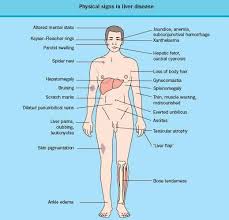 Pin On Medical