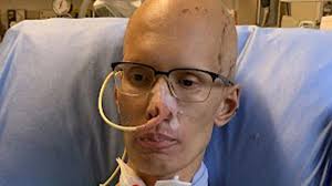 I lost 40lbs and the ability to speak after my body started eating itself