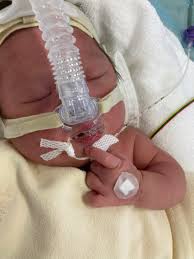 NICUで初面会 | ダウン症&ファロー四徴症(先天性心疾患)・めいちゃんケアのブログ