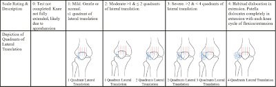 Image result for Patellar Apprehension Test