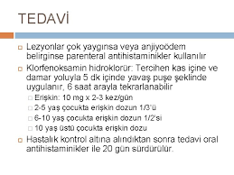 ocuklarda astim atopk dermatt rtker ara gr dr