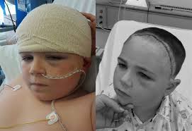 Moray schoolboy gives back to epilepsy medics after life-changing surgery