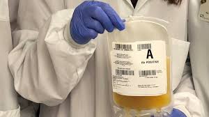 Image result for Plasma Transfusion