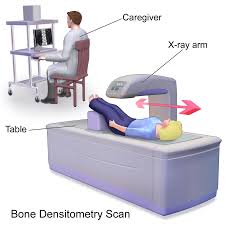 Bone Density Dexa Test Scan Cpt Code 77080 Vs 77081 Medical Coding Guide