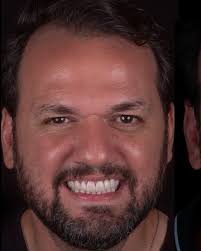 Gustavo Julius S. Bruno (@dr_gustavojulius) · Campo Grande, AL