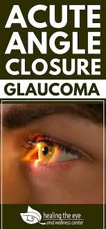 Pin On Eye Problem
