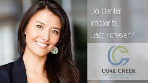 This can be done at the same time as the implant insertion. Dental Implants Best Dental Implant Center Lafayette Co