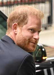Prince Harry could be balding due to ...