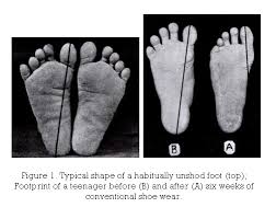 It is the terminal portion of a limb which bears weight and allows locomotion. The Science Of Foot Dysfunction And Cure Part 1 Shoe Shaped Feet Scientific Article The Science Explore Joe Nimble