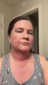 Morpheus 8 Day 3 update.