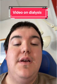 #dialysis #dialysislife #hemodialysis #kidneyfailure #CKD #CKDJOURNEY #Igan  #kidney #kidneytransplant