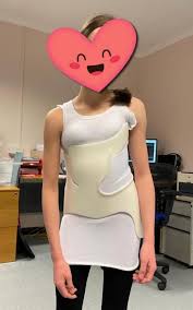 نتائج الدراسات الحديثة حول تأثير حزام اعوجاج العمود الفقري على حركة اليدين والذراعين لدى الأطفال