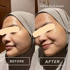 Transforming my skincare journey with Susenji Luna